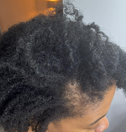 The Real Reason Your Natural Hair Is Dry, Breaking, or Thinning